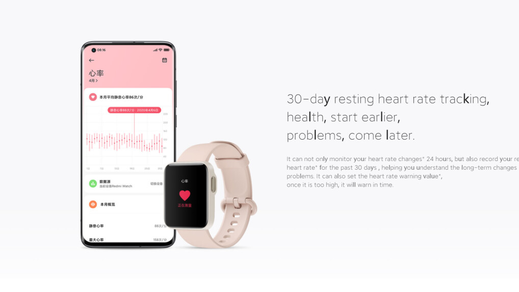 Xiaomi Redmi Watch in Bildern - Bild 5 von 5