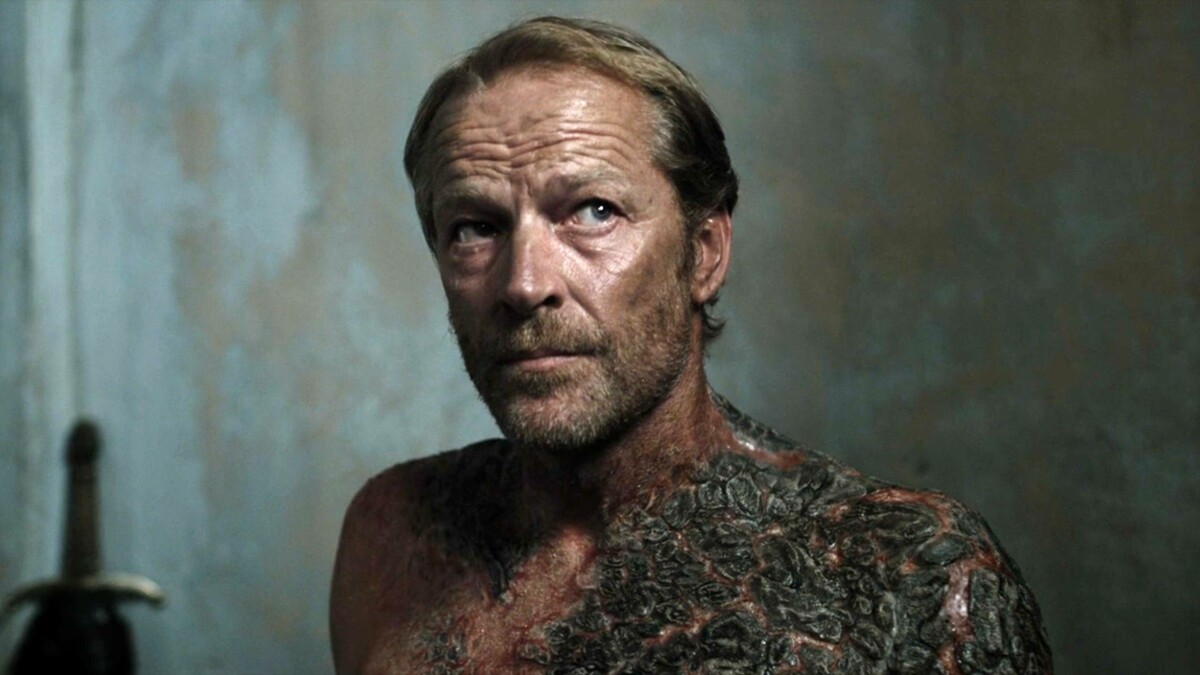 Juego de Tronos: Ser Jorah Mormont enferma de escala de grises